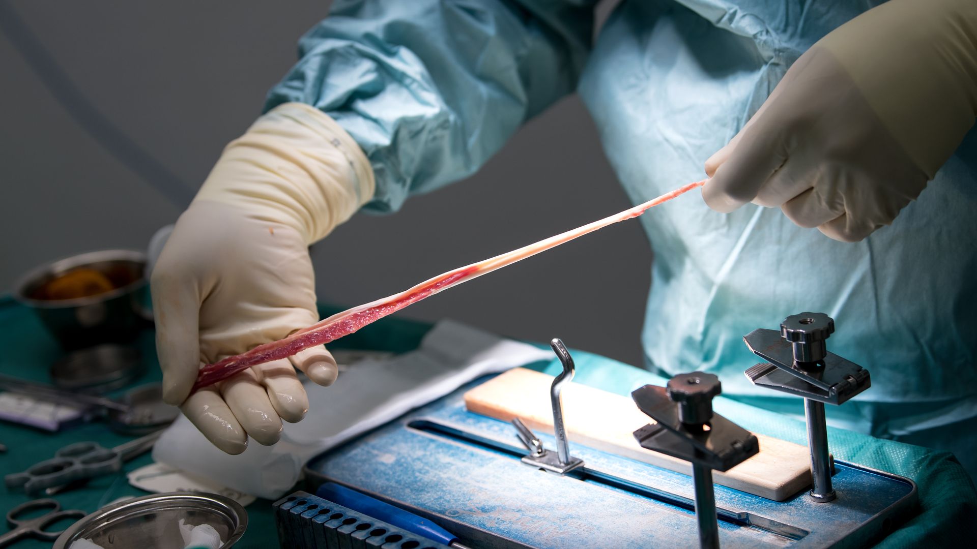 A surgeon holds a knee tendon above a table full of medical devices.