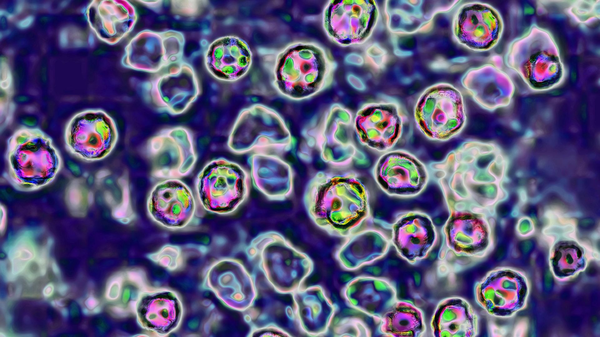 Measles virus
