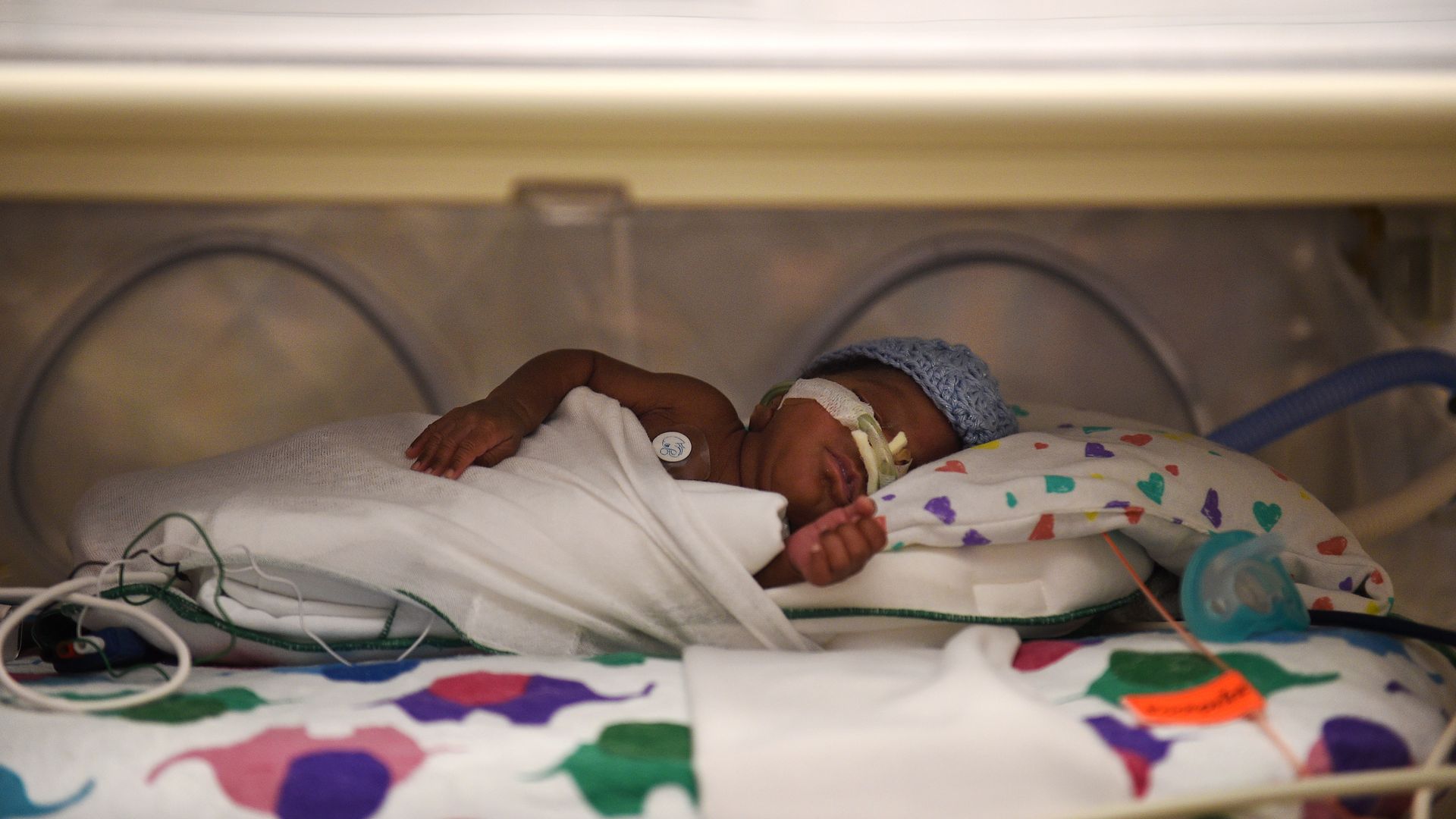 An infant is wrapped in blankets and treated in a hospital neonatal intensive care unit.