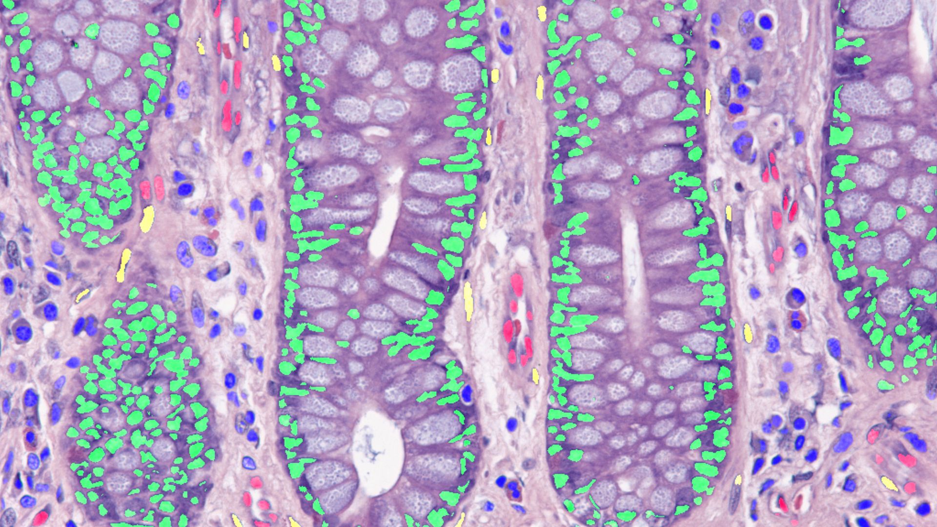 Stained intestinal glands with single cell data overlaid as fluorescent colors representing different cell typse