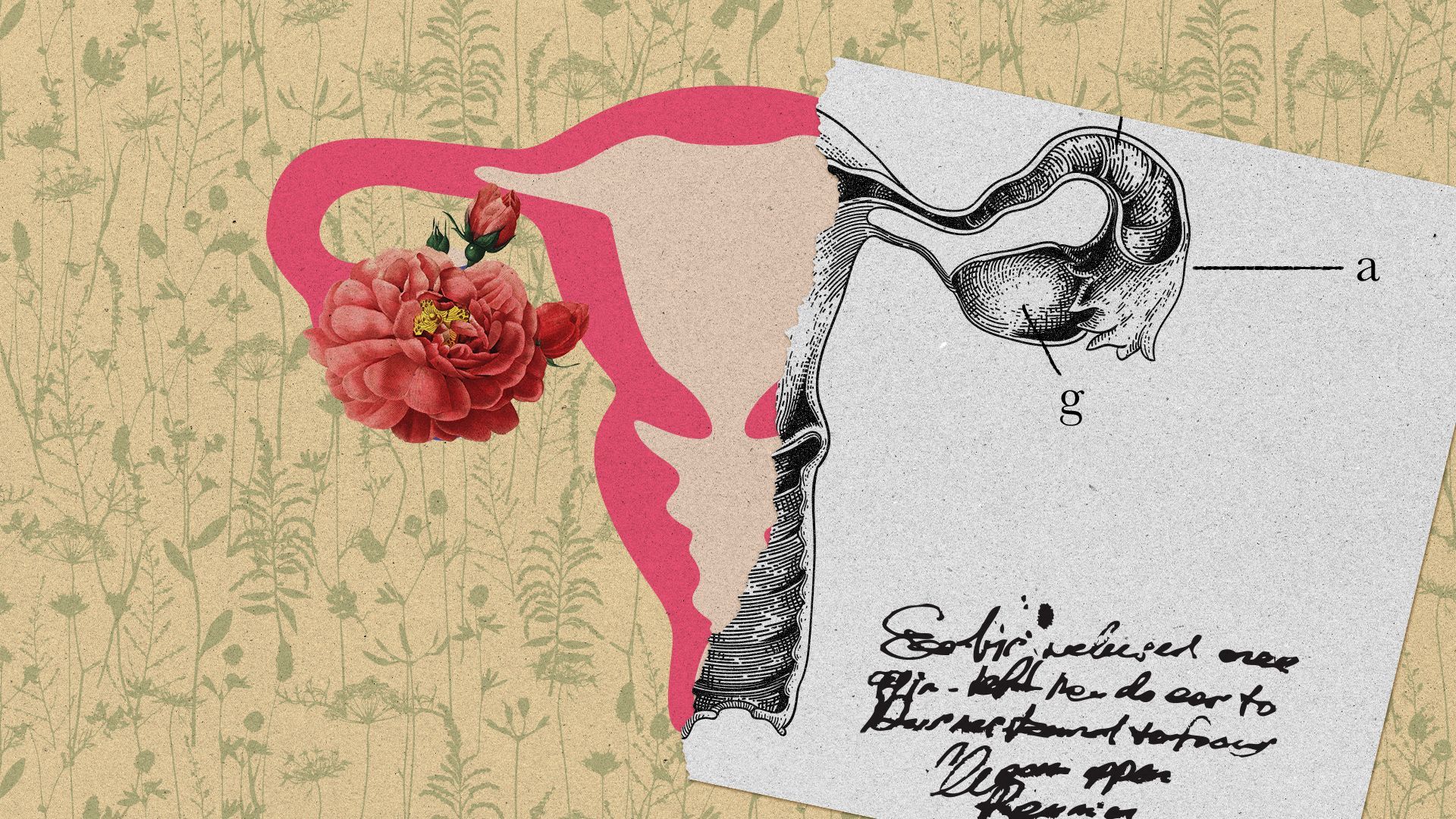 Illustration of a torn medical illustration of a uterus overlaying a colorful, modern uterus illustration featuring a rose.