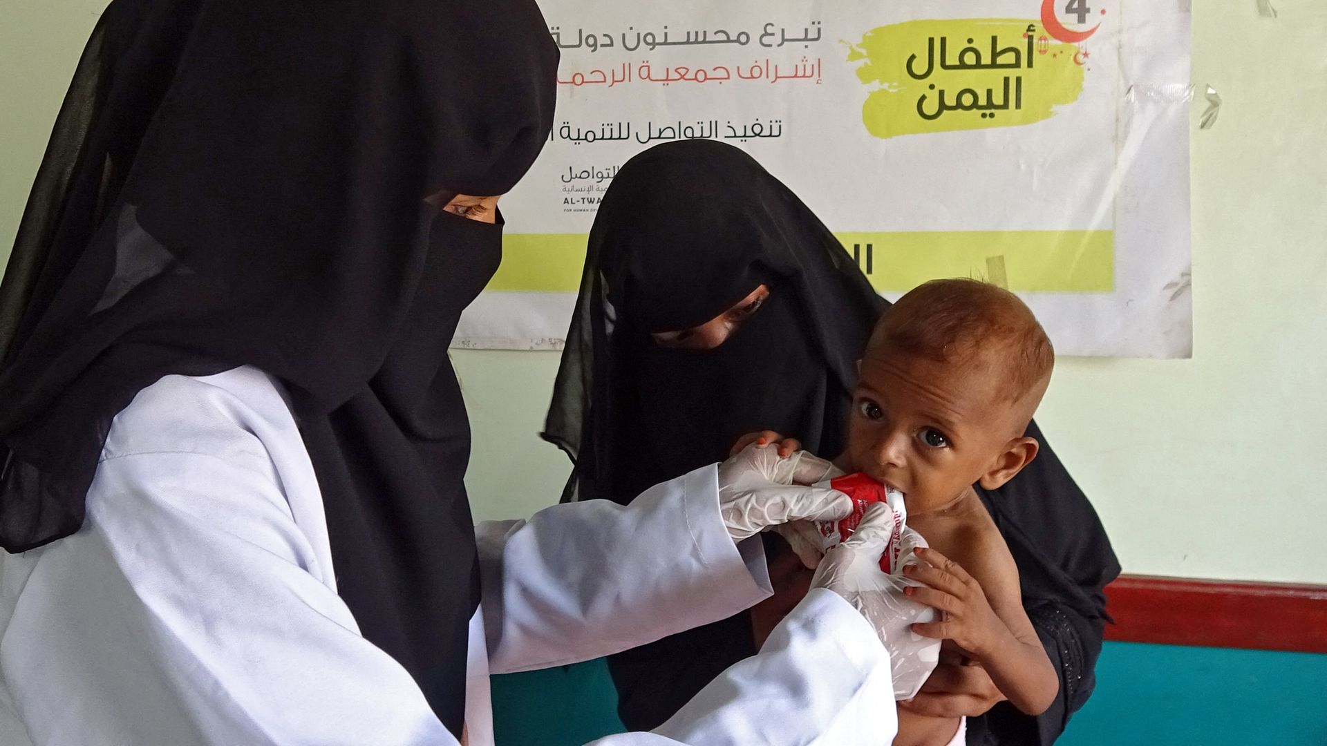 A nurse tends to a malnourished child at a treatment centre in Yemen's western province of Hodeida.