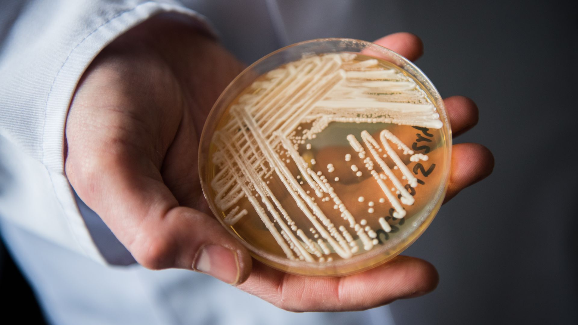 A hand of a person in a lab coat holds up a lab dish with fungus in it.
