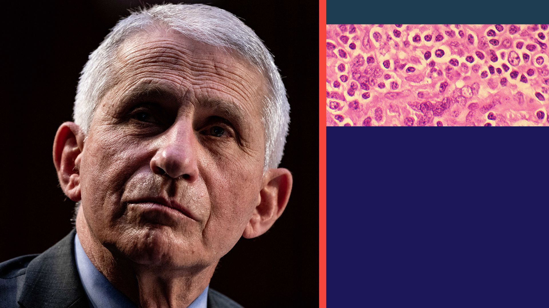 Illustration collage of Dr. Anthony Fauci and HIV cells