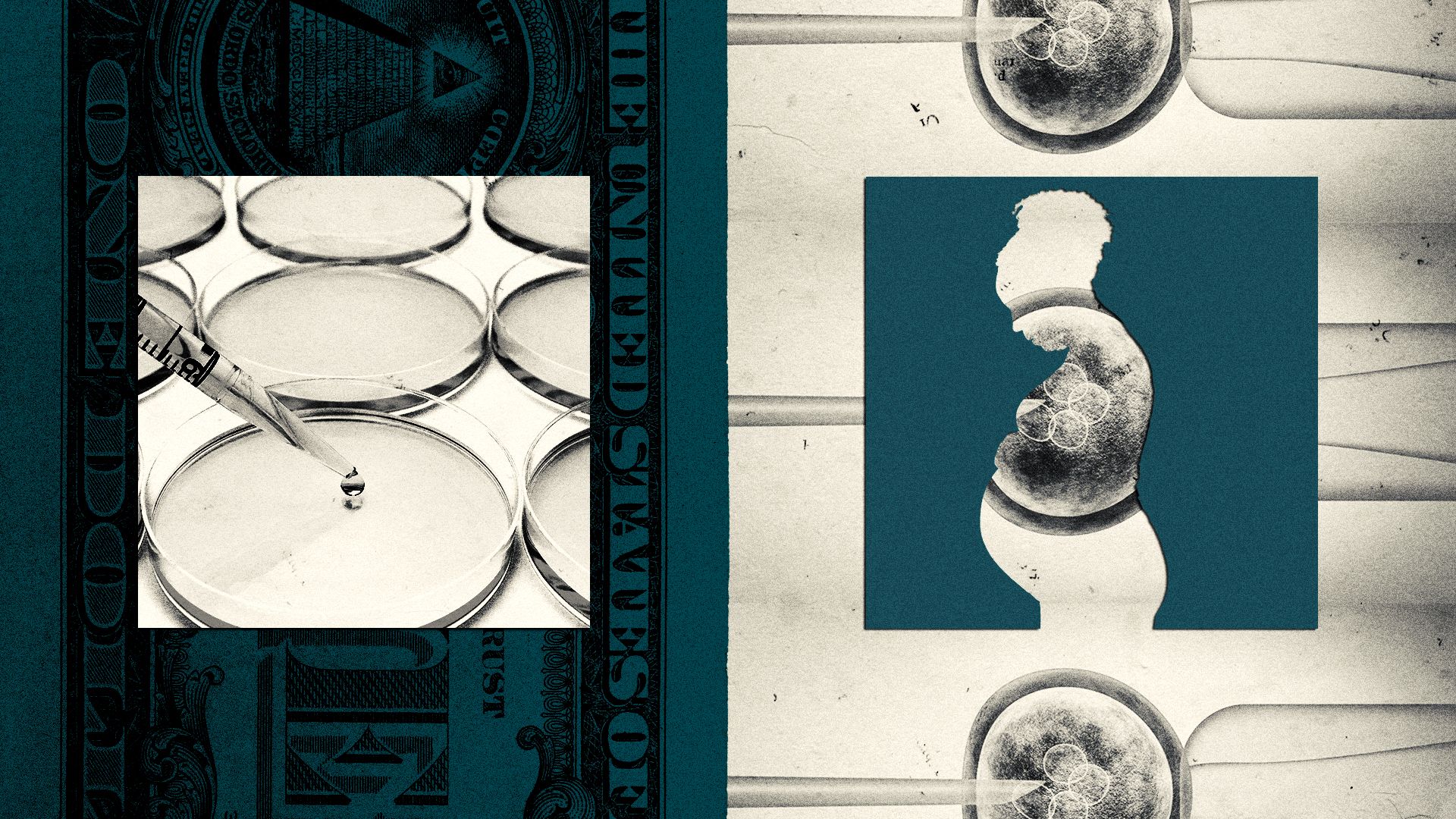 a collage illustration of money, petri dishes, in vitro fertilization and a cutout of a pregnant person 