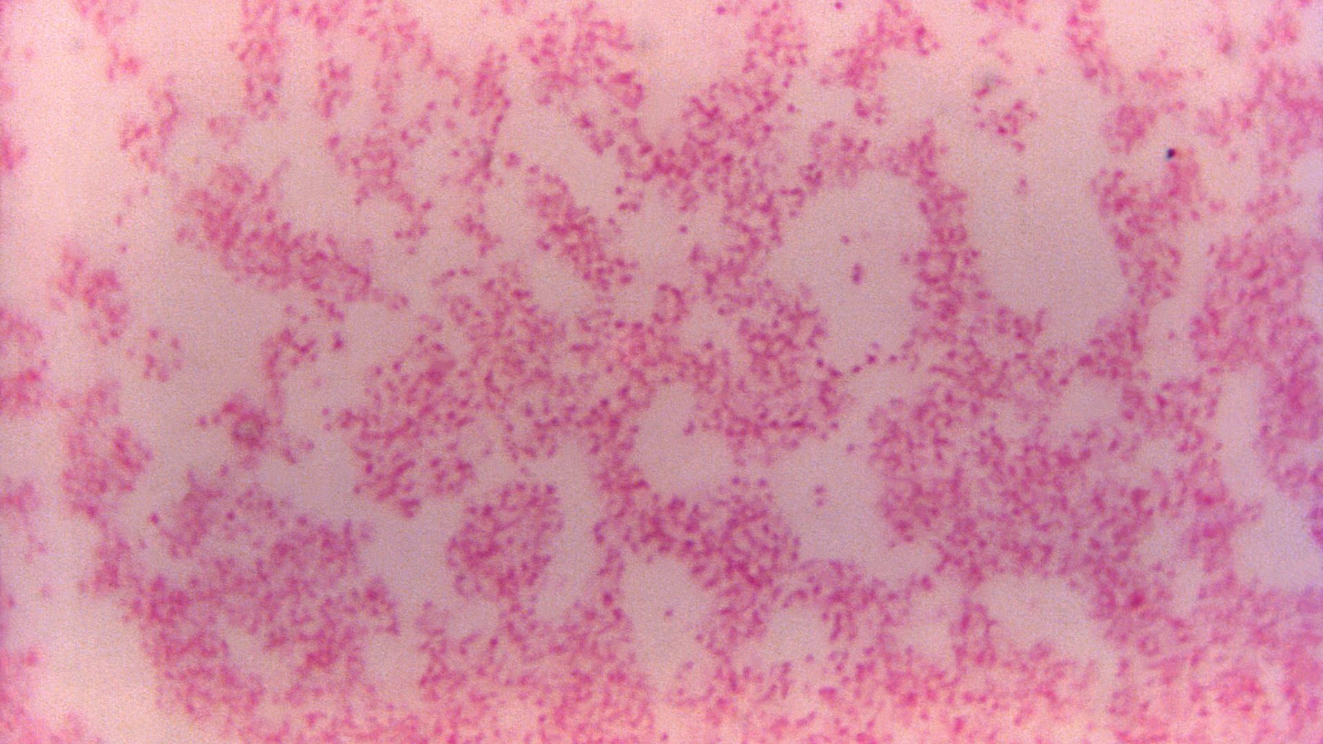 Microscopic image of numerous Francisella tularensis bacteria stained with safranin at 1,000x magnification. The bacterium causes tularemia and is considered a potential bioterrorism agent because of its high infectivity.