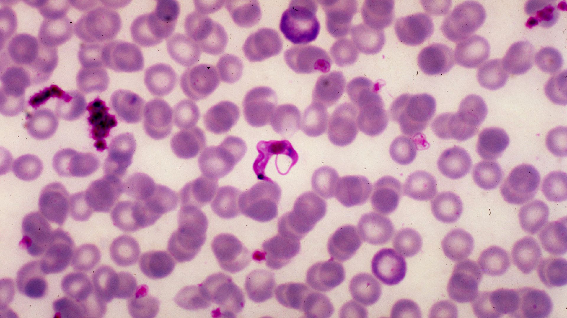A micrograph of Trypanosoma cruzi.