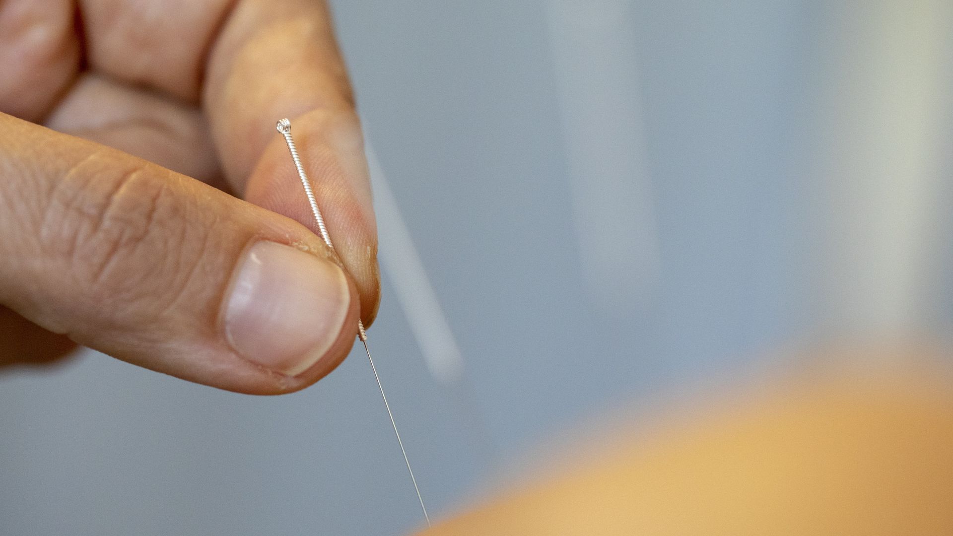 Medical staff performs acupuncture.