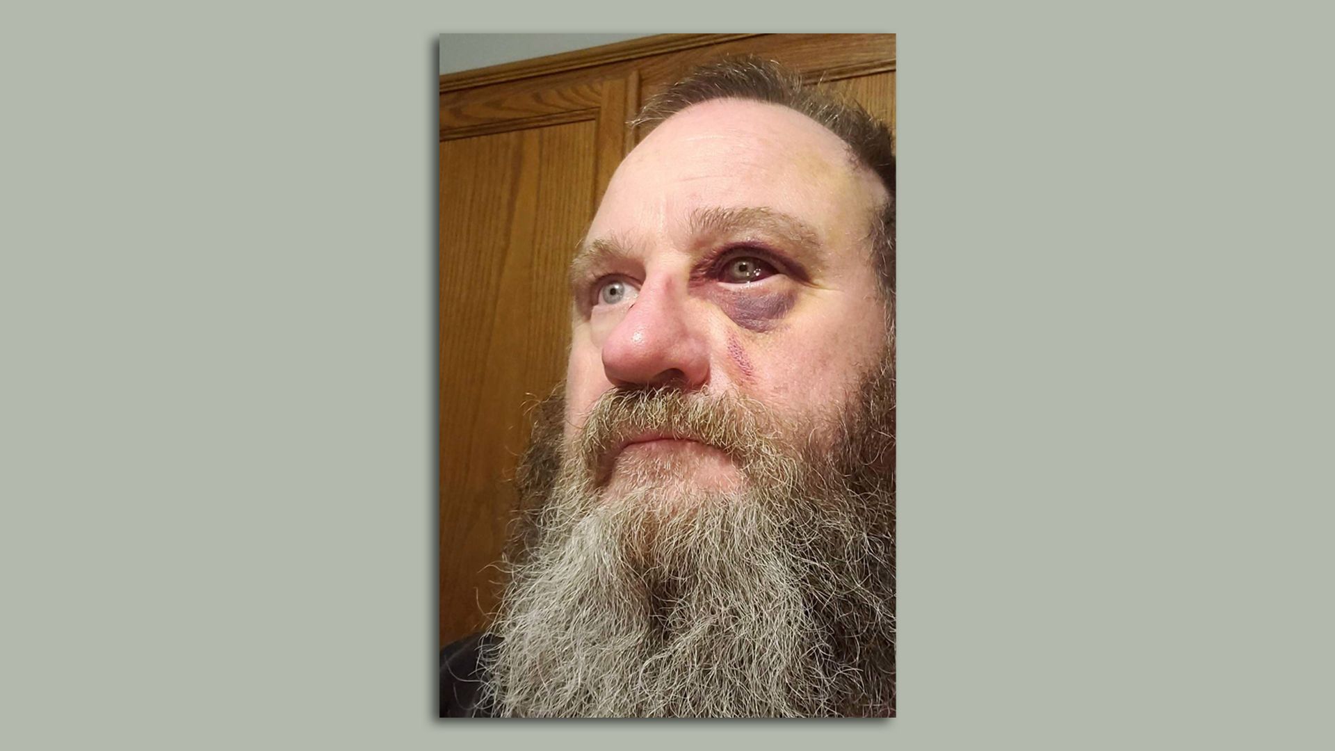Mark Dinning was injured in a fight over a COVID-19 face mask. Dinning’s attacker faces a mandatory 10 year prison sentence next month. Photo: Polk County District Court