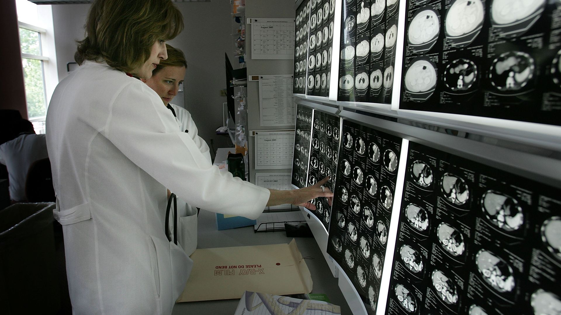 Doctors review scans of scans of a patient being treated at the Kimmel Comprehensive Cancer Center at Johns Hopkins