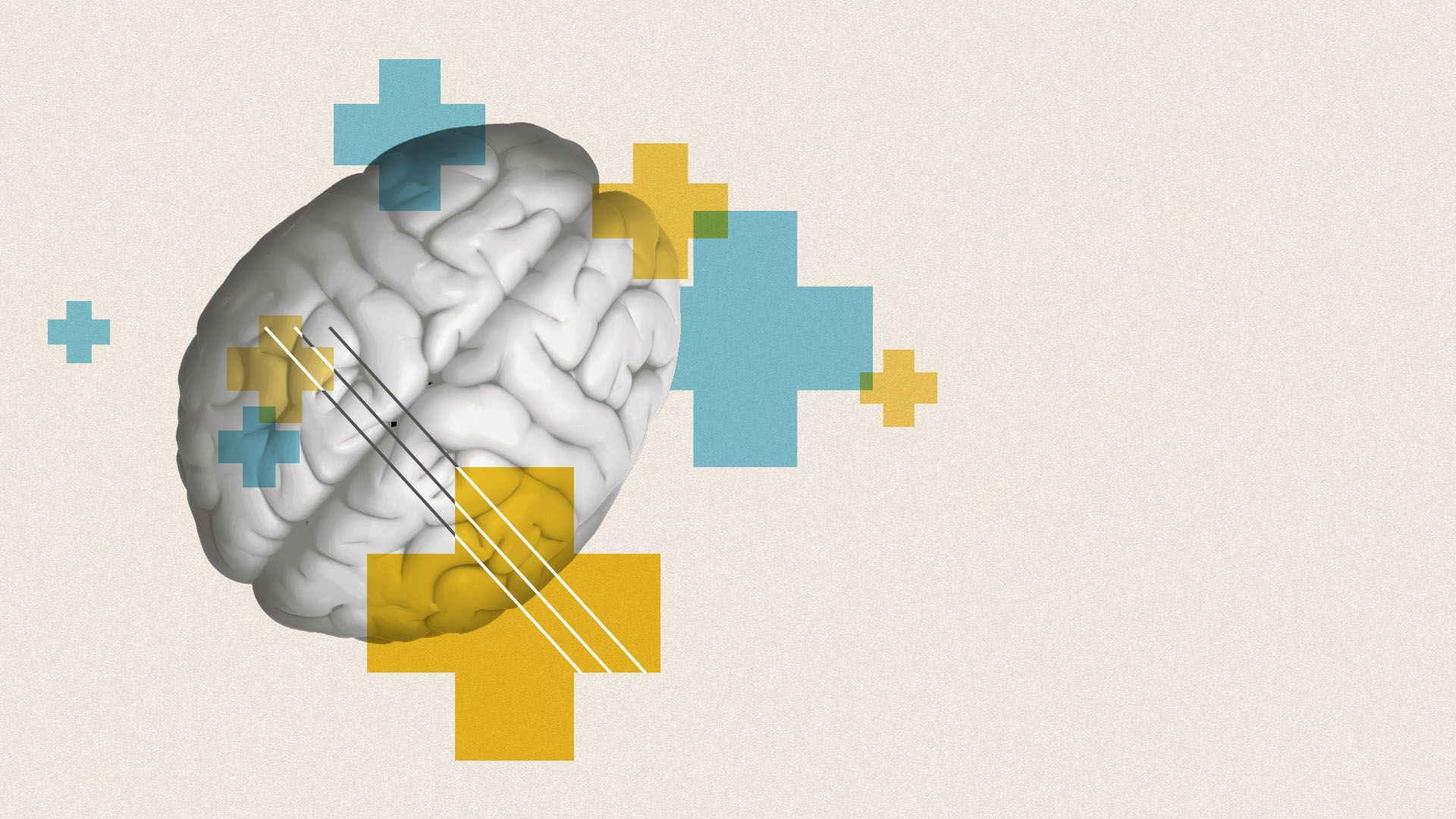 Illustration of a brain surrounded by medical crosses and lines.