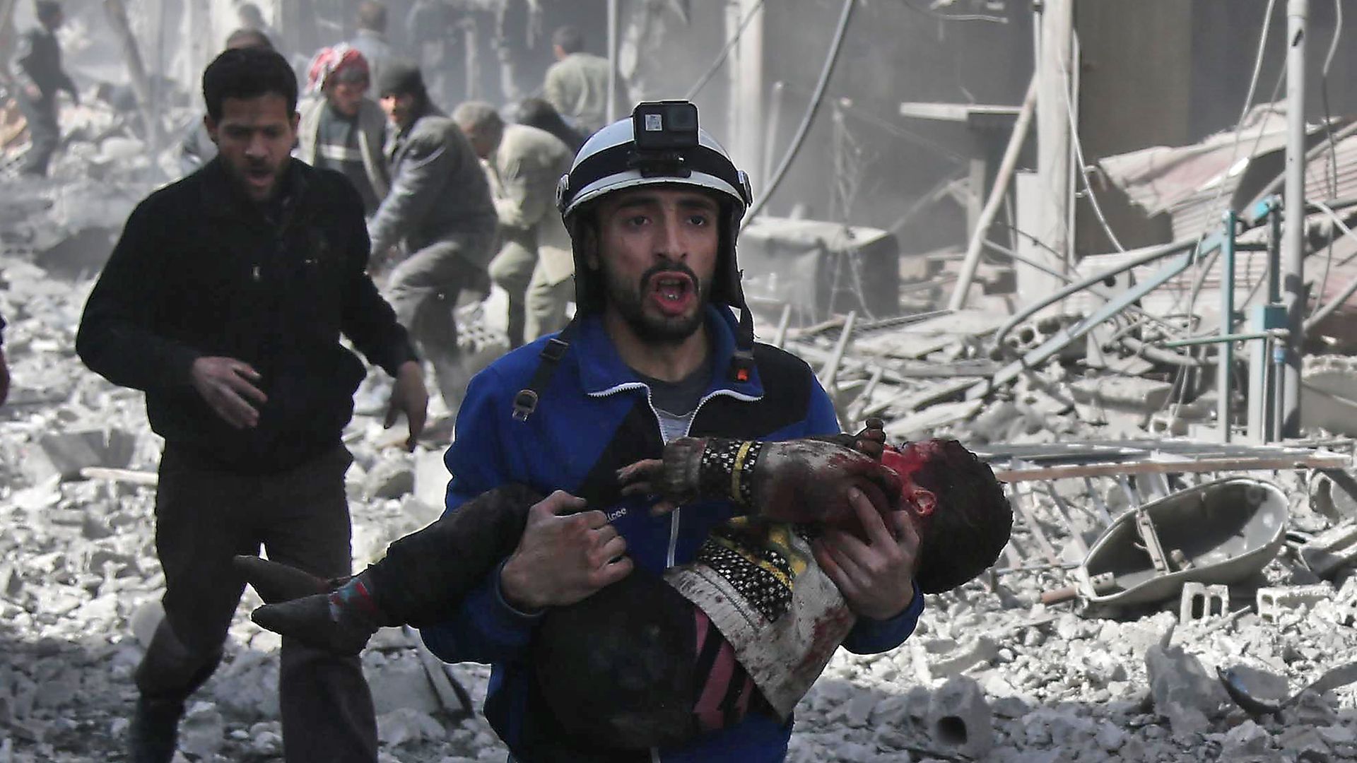  A Syrian civil defence member carries an injured child rescued following government bombing in the Eastern Ghouta region