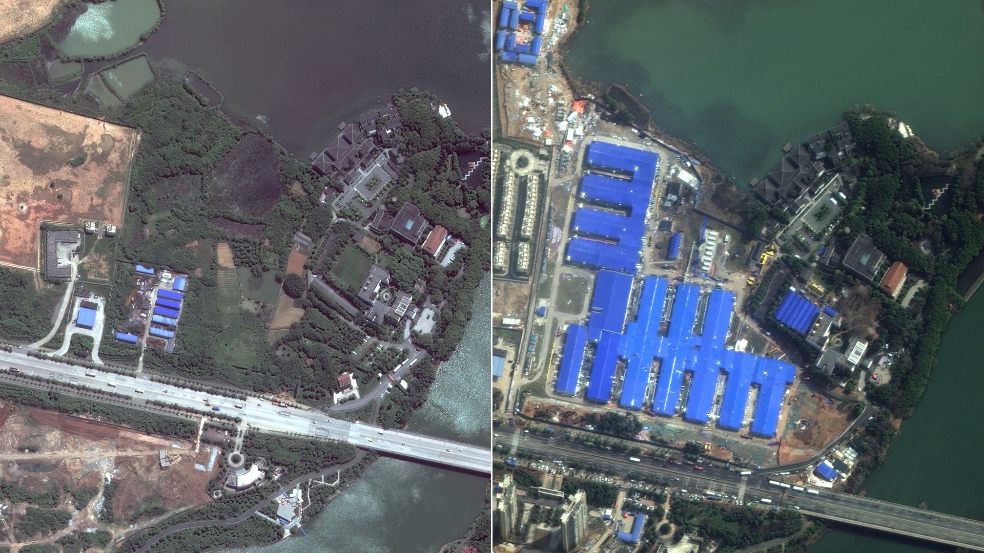 A before and after of a hospital with a blue roof built in China