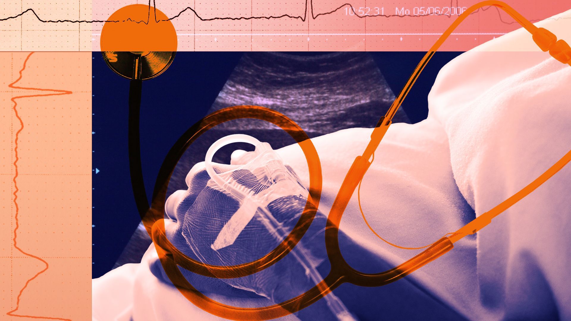 Illustrated collage of a pregnant person, an ultrasound, various EKGs, and a stethoscope