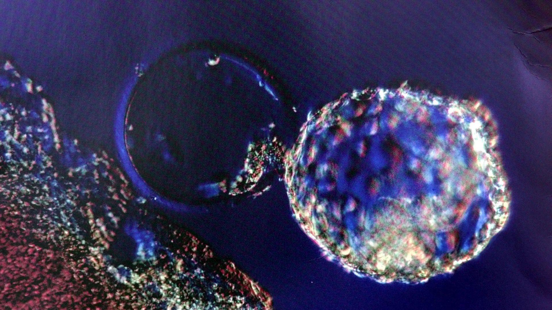 A close-up photo shows two round shapes 