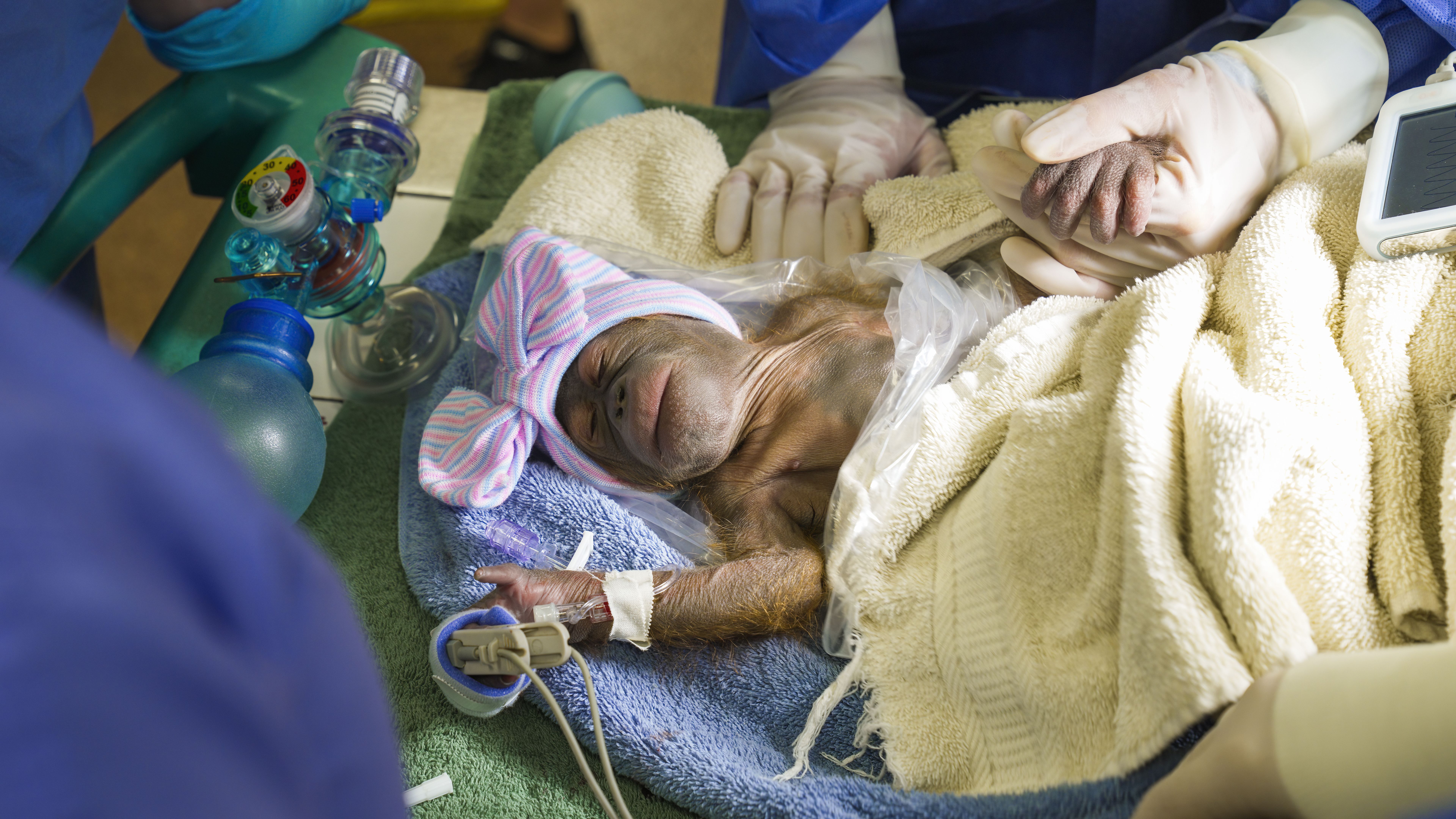 Baby orangutan wearing a bonnet in the hospital. a gloved worker holds its hand