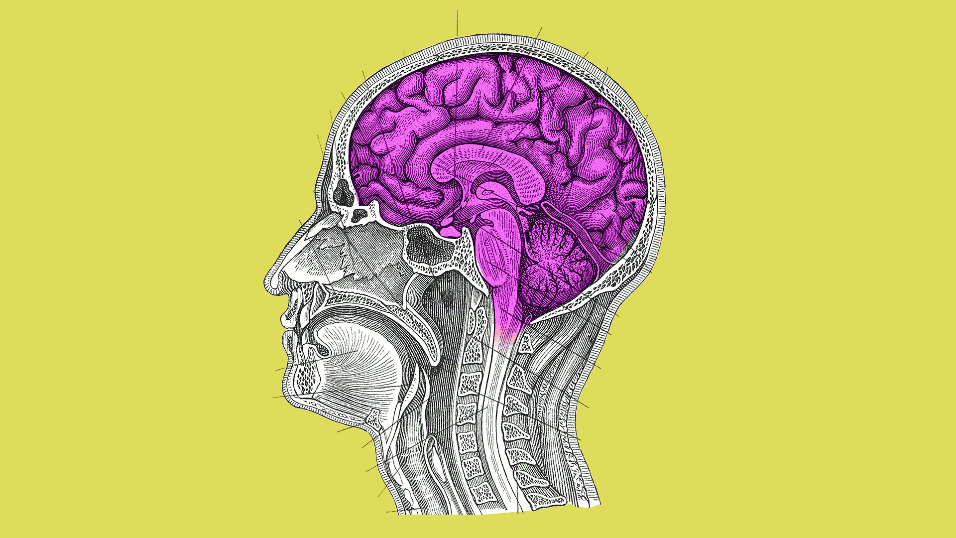 Illustration of a medical drawing of a cross section of a head with the brain shifting through a range of colors