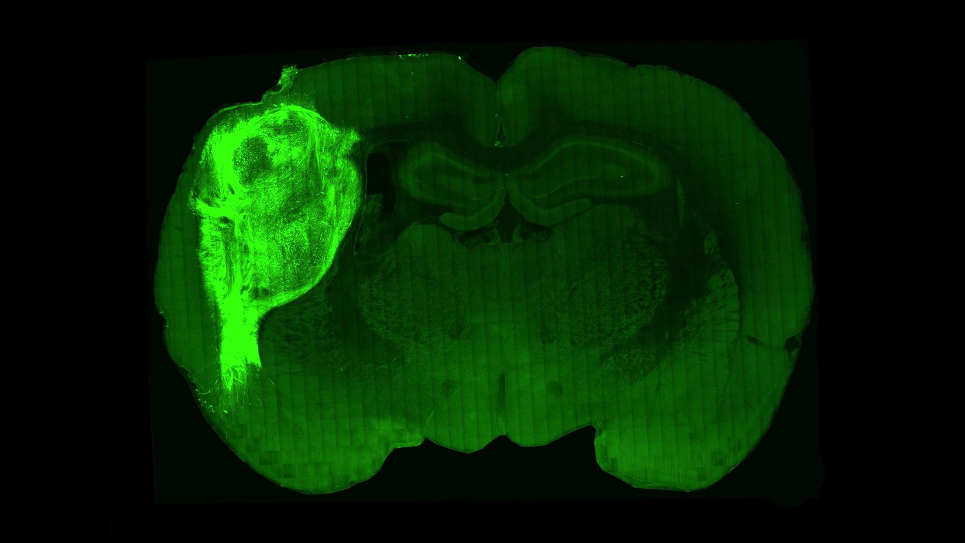 Cross-section of a rat brain shows tissue from a human brain organoid in brighter green