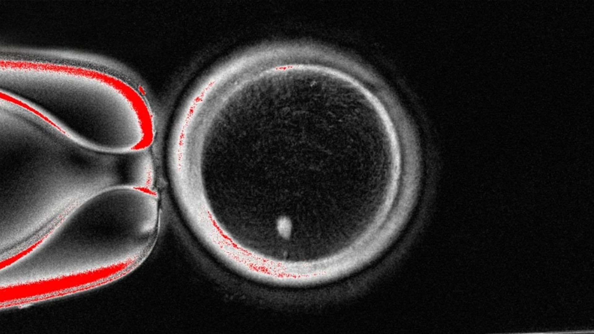 An image of a white oocyte, or egg, with a bright white image of a skin cell nucleus, featuring red coloring, before fertilization. 