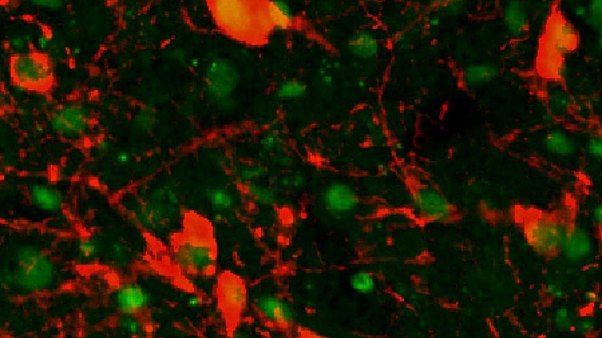 Stem cells can replace nerves damaged by Parkinson's in monkeys