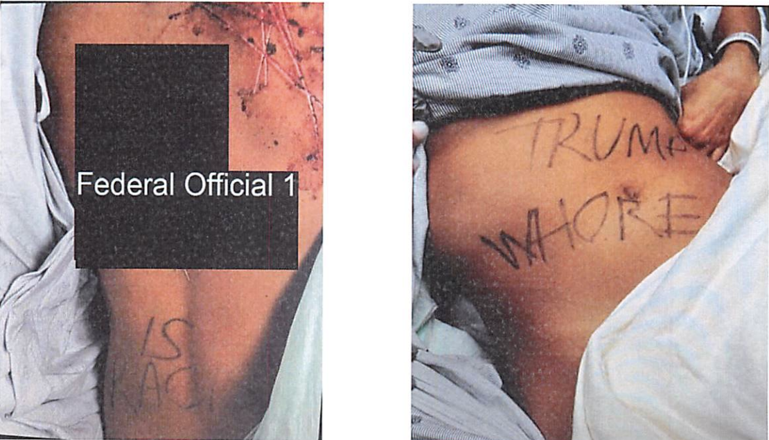 Two photos showing parts of a person's body with writing on the skin. Left image has 'IS RAC' written partially visible. Right image shows "TRUMP WHORE" written in black ink on the exposed torso.