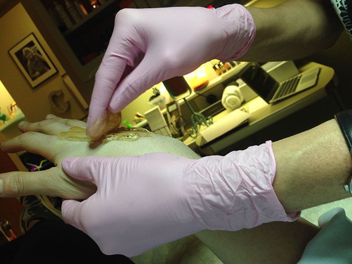 sugaring hair removal