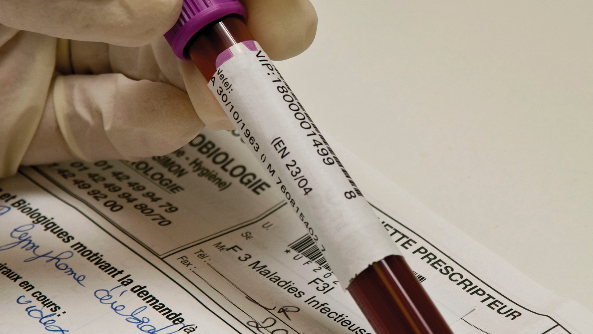 Doctor holding vile of blood