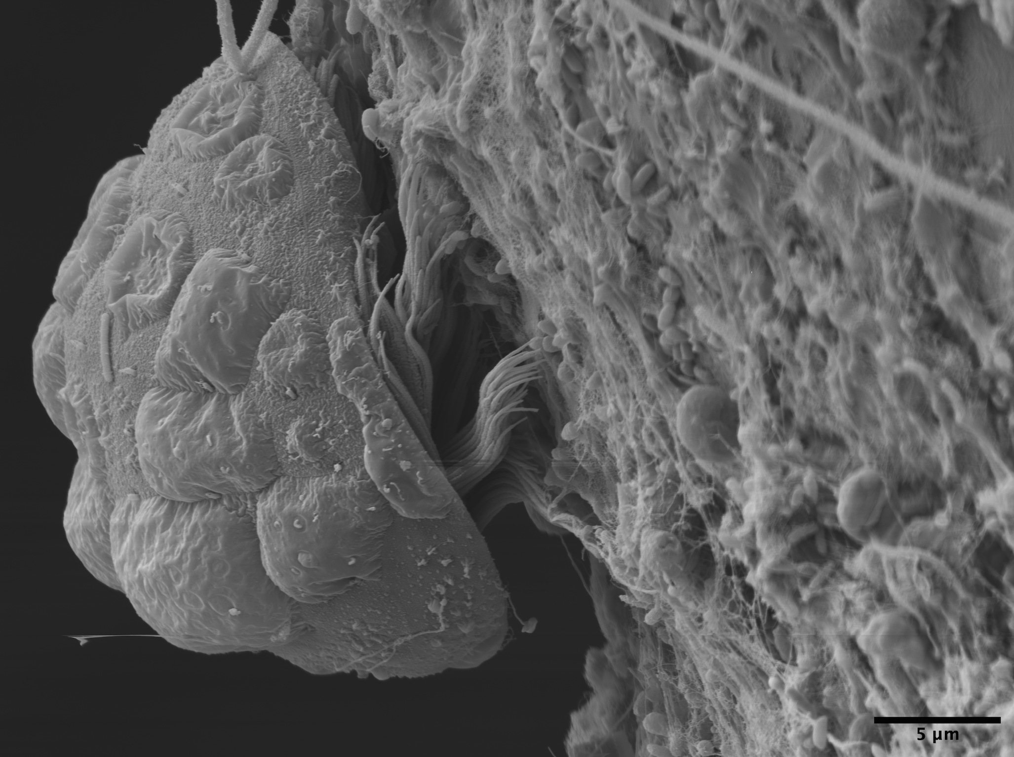 Grayscale scanning electron micrograph of a highly magnified biological surface with rough, layered textures and fibrous strands; scale bar at bottom right shows 5 µm.