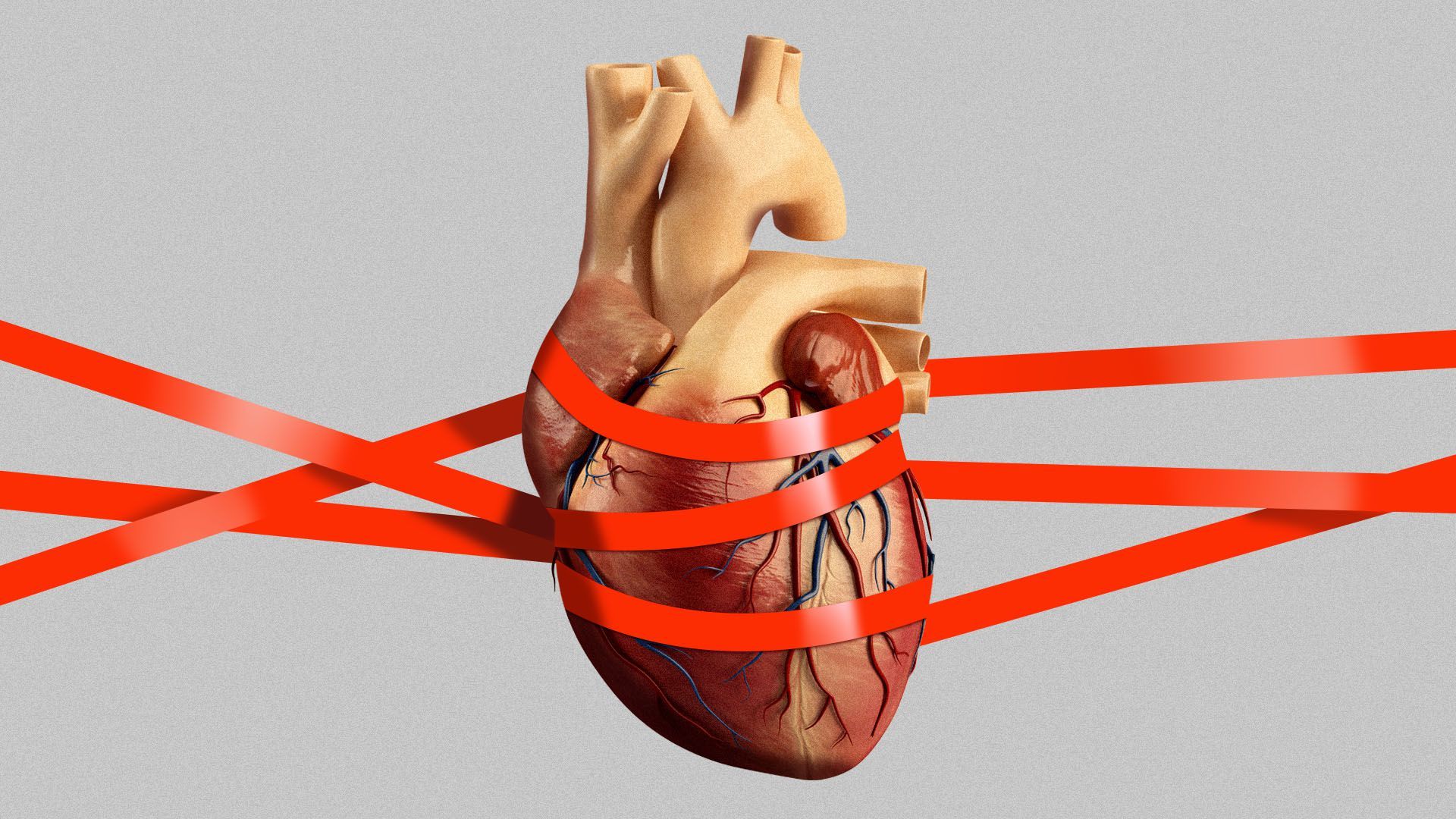 Illustration of a heart wrapped in red tape