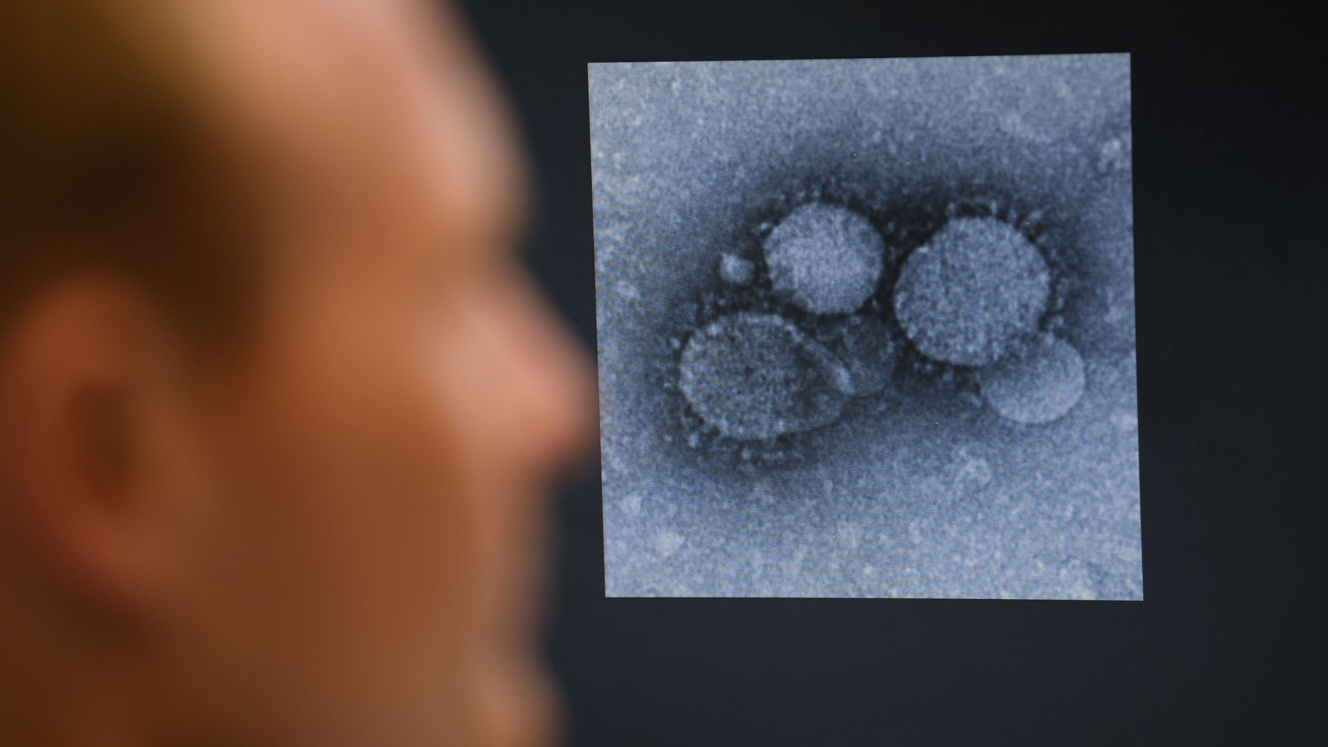Virologist Sandro Halbe is looking at an electron microscope image of a MERS coronavirus, a close relative of the novel coronavirus