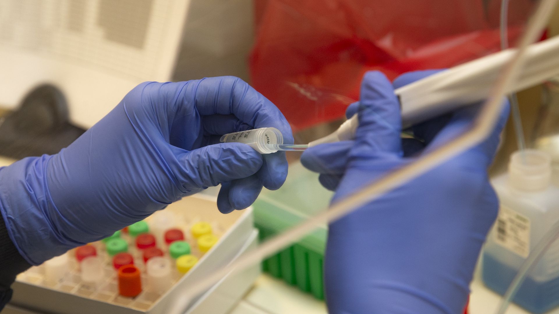 A medical researcher testing for antibodies against coronavirus.