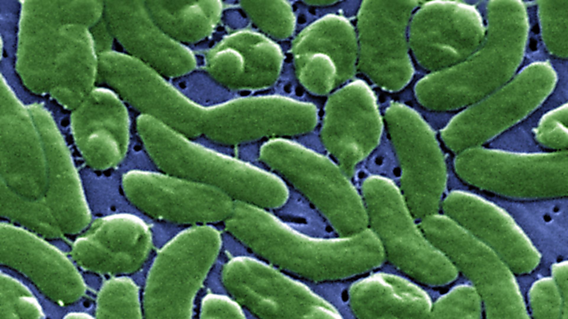 Vibrio vulnificus bacteria seen by an electronic microscope.