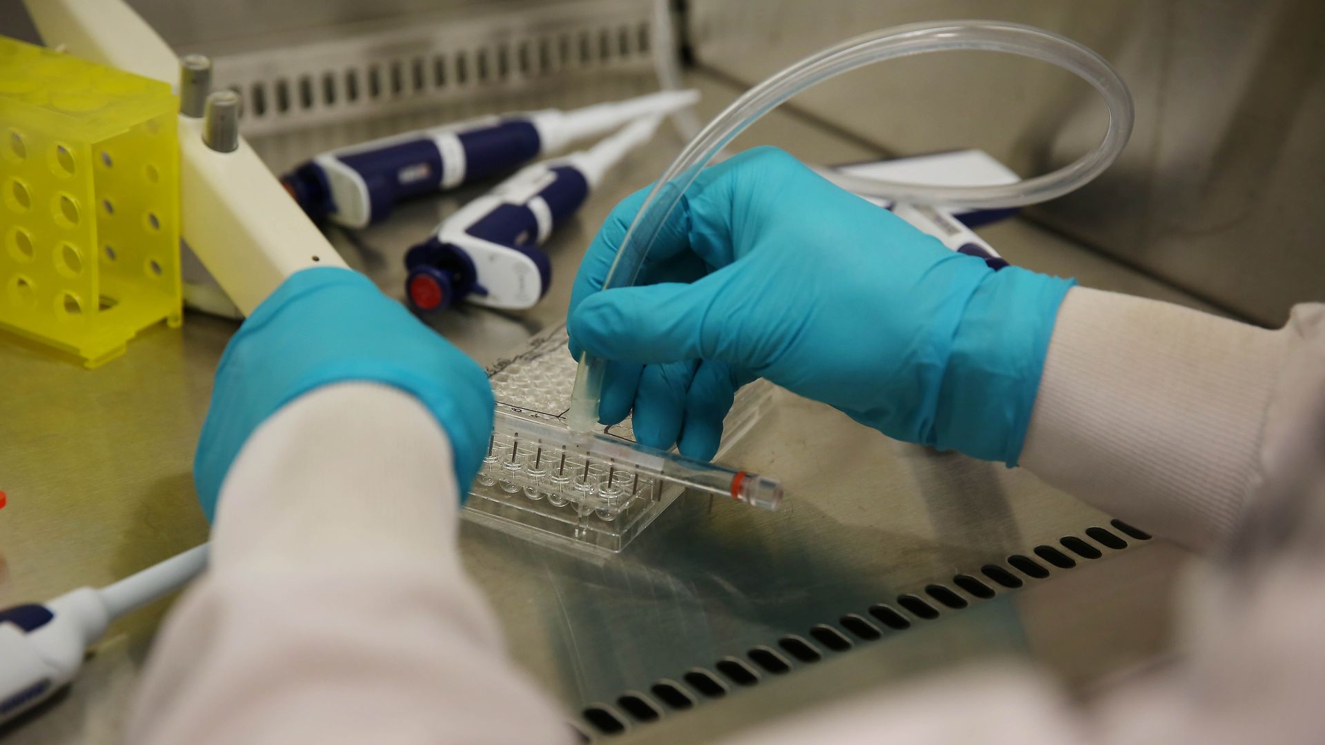Photo of a person putting pipettes in a tray