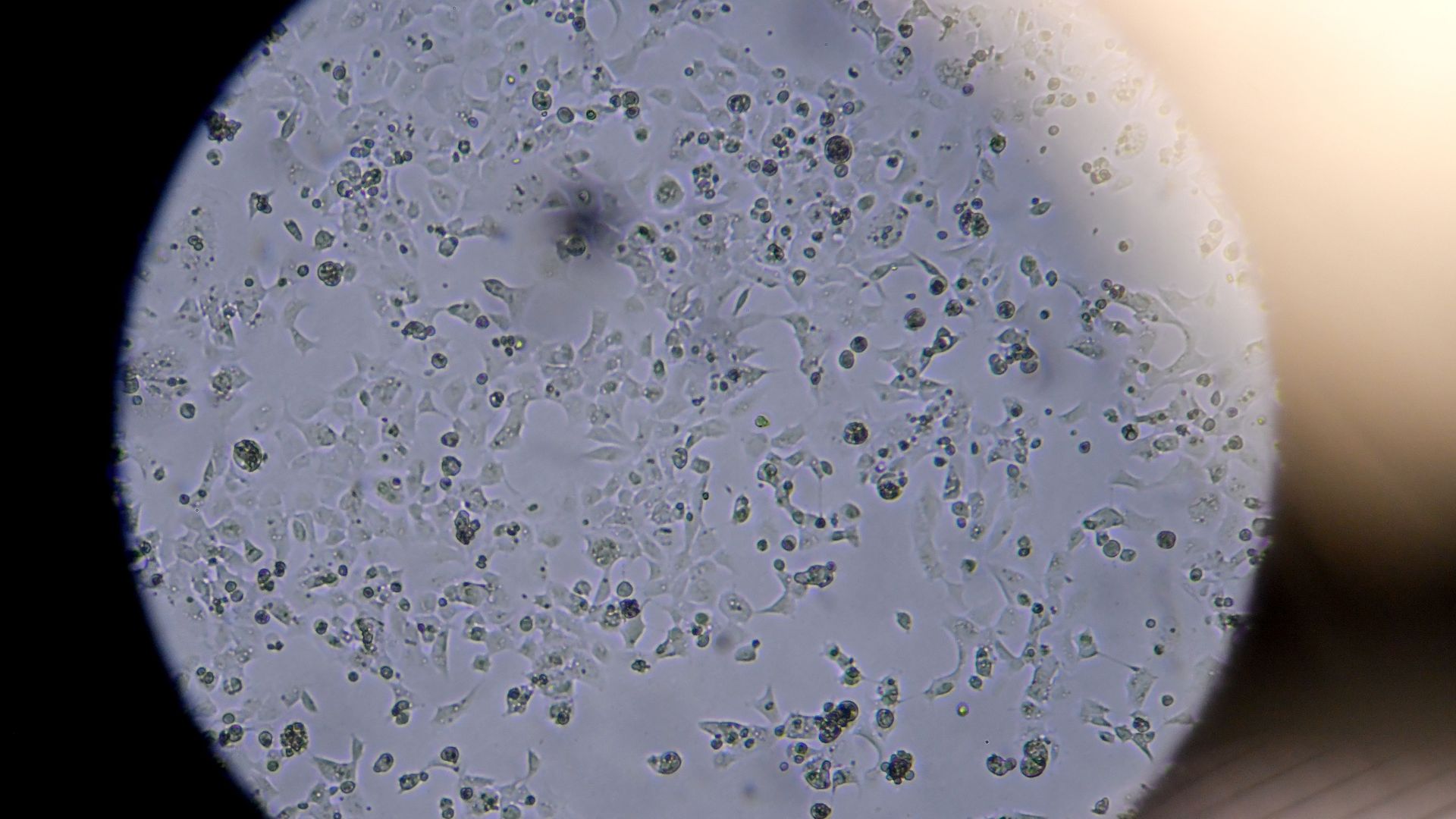 A microscopic view of the coronavirus