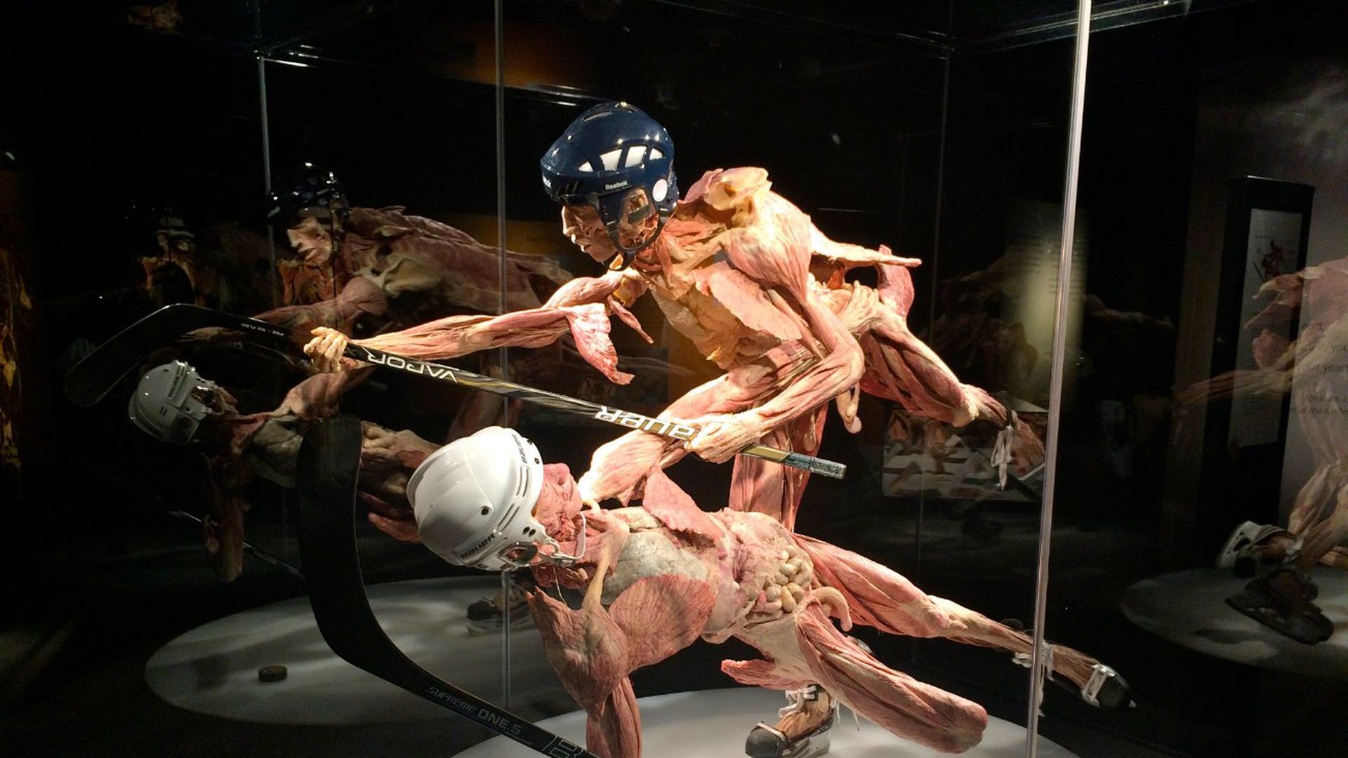 Body Worlds Charlotte