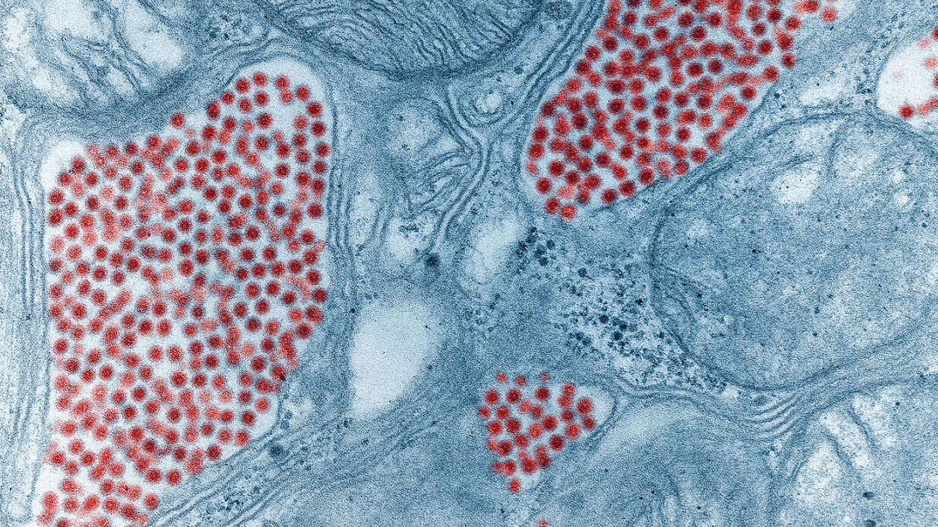  Colorized electron microscope image of mosquito salivary gland tissue infected by the EEE virus