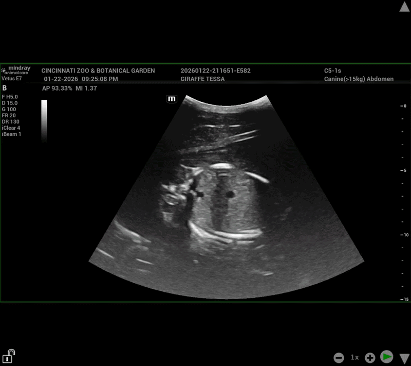 A sonogram offers a sneak peek at Tessa the giraffe's unborn calf. (Video: Courtesy of Cincinnati Zoo)