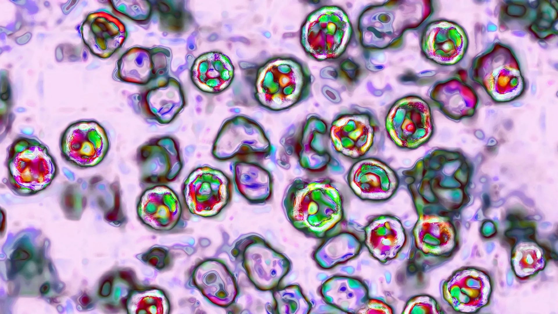 The measles virus, paramyxoviridae from the Morbillivirus family, transmission microscopy view. Photo by: BSIP/Universal Images Group via Getty Images.