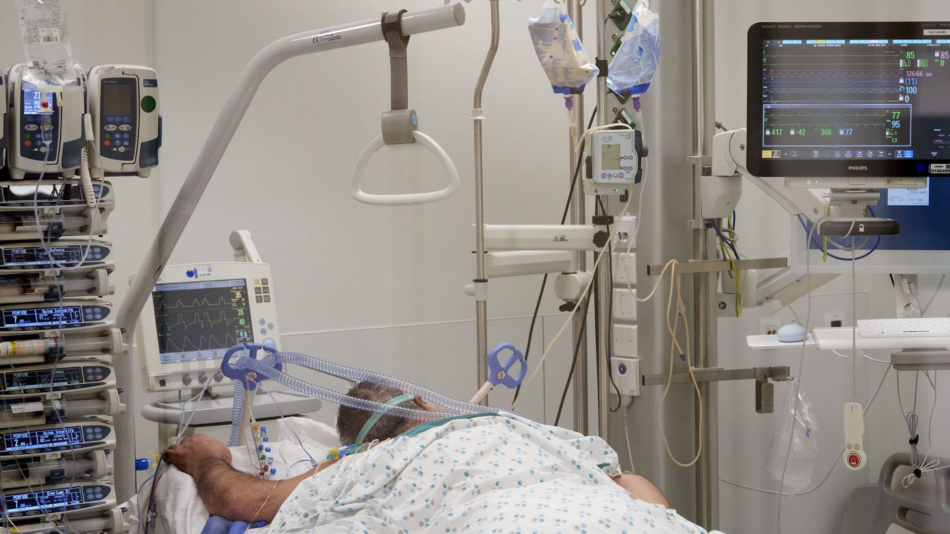 A man lays on a hospital bed in an intensive care unit with monitors and equipment surrounding him.