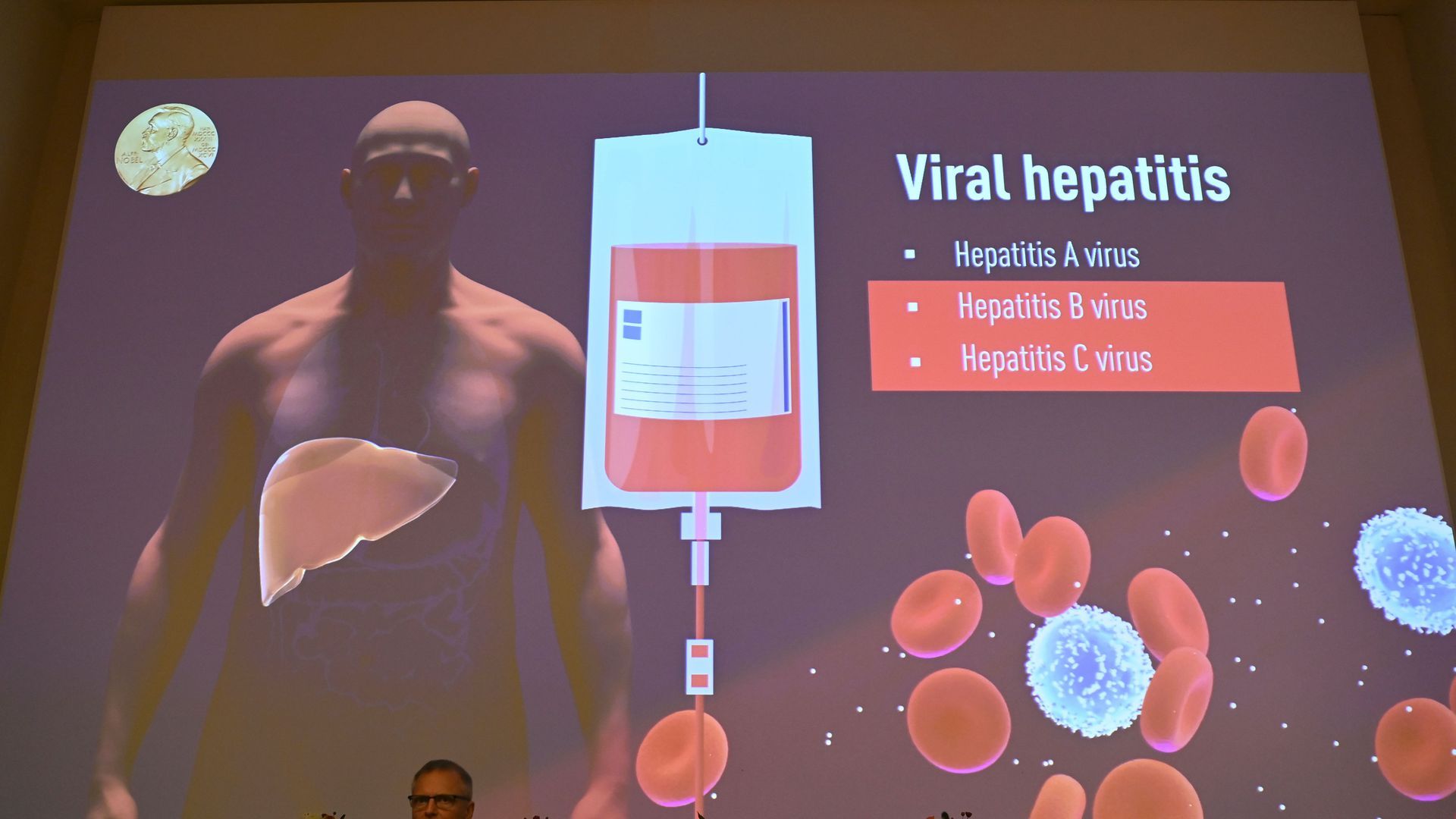 Picture of a screen that says Viral Hepatitis