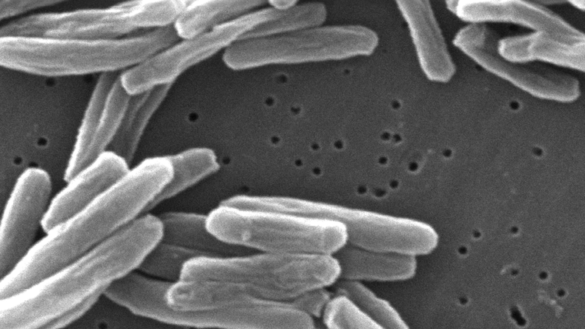 Mycobacterium tuberculosis bacteria under and electronic microscope in 2006.