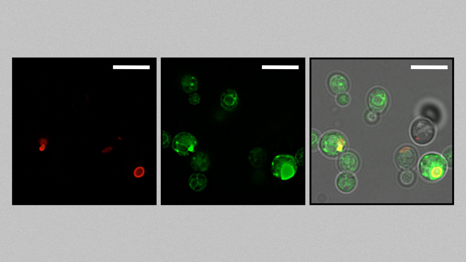 yeast cells glowing