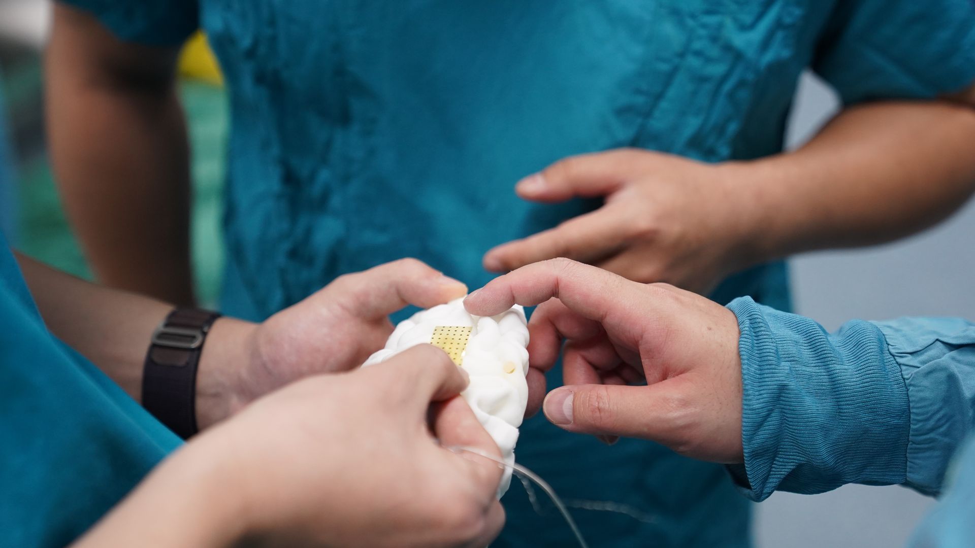 Chinese researchers with a brain implant