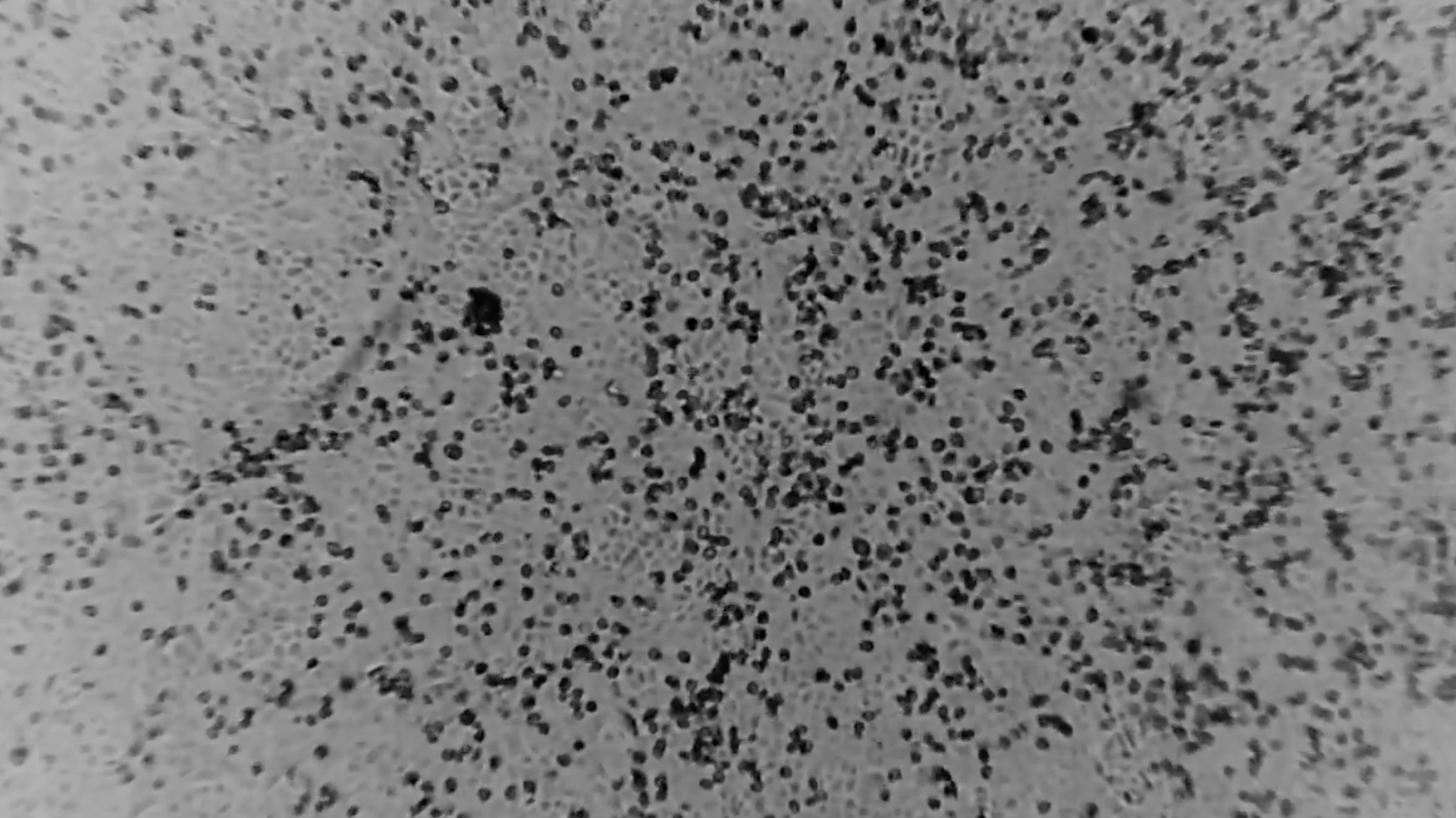 A screenshot of the coronavirus grown in a lab in Australia.
