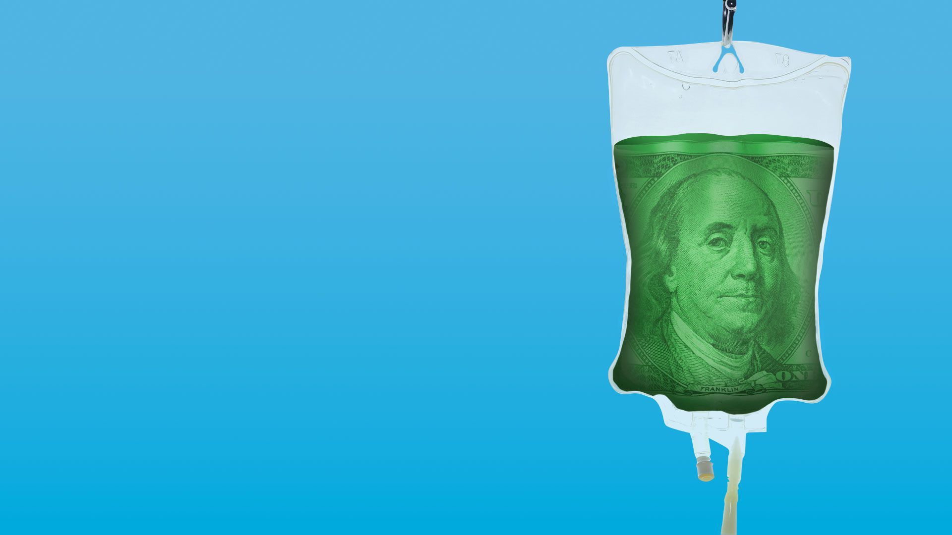 Illustration of a saline bag solution with money as the liquid in the bag. 