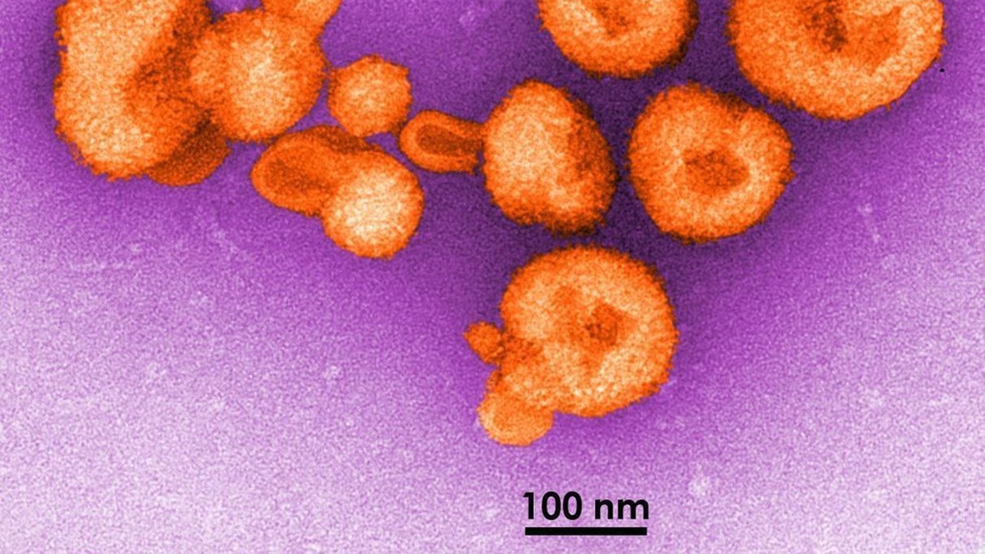 Scientists develop blueprint for vaccine against deadly Lassa virus