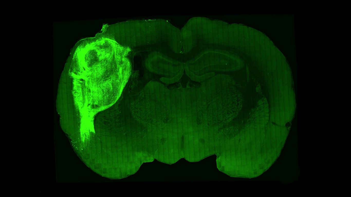 Human cells in rat brains could offer new insights on autism, other ...