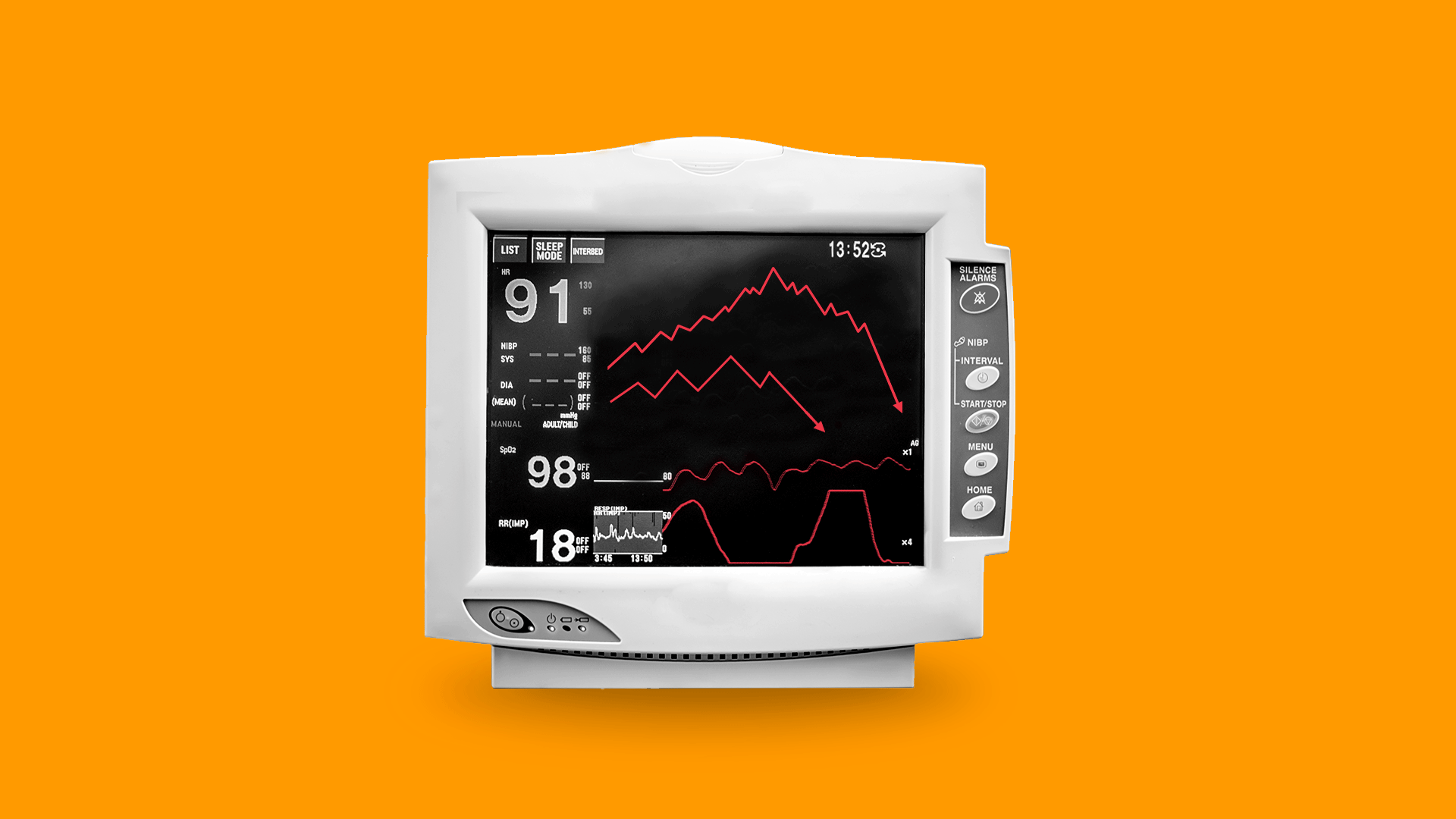 Illustration of an EKG machine with downward pointing market trend lines in place of heartbeat information.