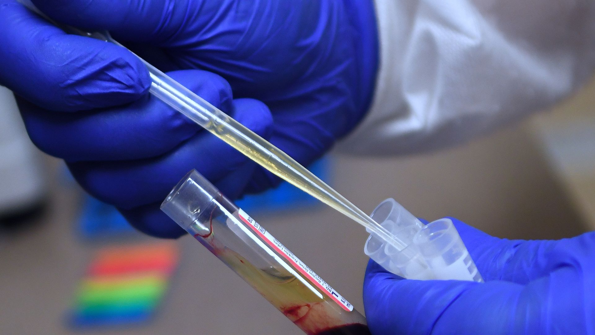 A laboratory technician preparing a blood sample in August for a vaccine clinical trial sponsored by Moderna.