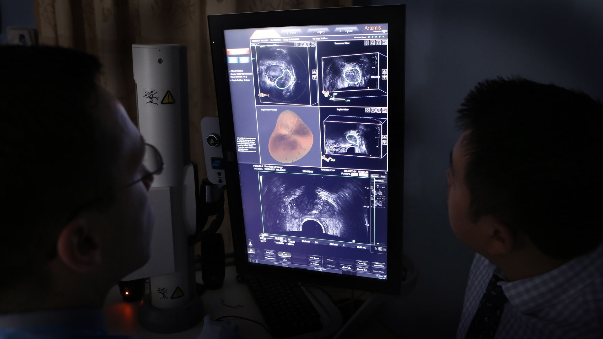 Ultrasound and MRI images are combined to increase accuracy of taking biopsies from the prostate of a patient.